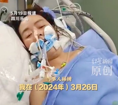 女子唇部打針數(shù)日后入院搶救 唇部打針后該如何護理避免中毒危害
