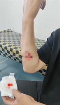 貨車(chē)司機(jī)無(wú)人區(qū)起夜被獨(dú)狼咬傷 卡友提醒注意安全
