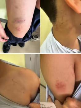 男孩疑遭機(jī)構(gòu)老師扇耳光 事件引發(fā)廣泛關(guān)注