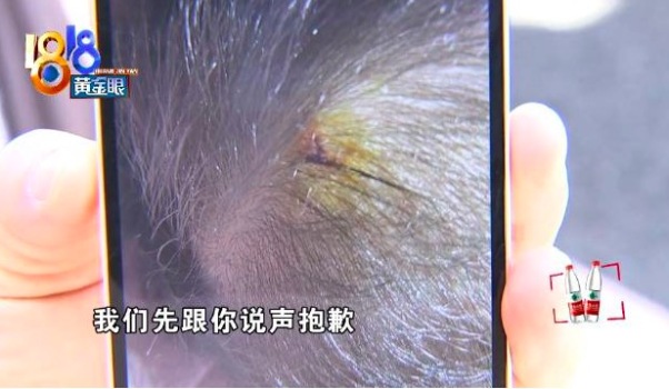 “地鐵場景”受傷,！孩子拍照時受傷媽媽說機構(gòu)沒關(guān)懷