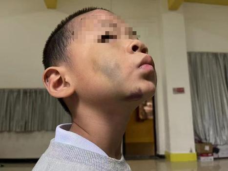 男童遭虐待致輕傷二級 生父被刑拘 繼母行為待查證