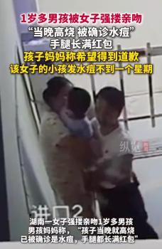 被女子強(qiáng)摟親吻男孩媽媽憤怒回應(yīng) 孩子隨后確診水痘