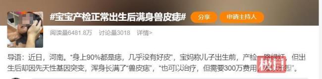 宝宝产检正常出生却满身兽皮痣 基因突变所致