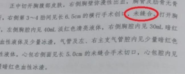 小洛熙舅舅发声 手术过失引争议