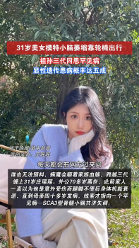 31歲美女模特祖孫三代同患罕見(jiàn)病 堅(jiān)強(qiáng)面對(duì)命運(yùn)挑戰(zhàn)