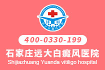 衡水白癜风哪家治的效果好