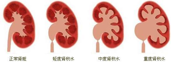 腰经常酸痛是肾脏有疾病吗?做肾功能检查哪里好