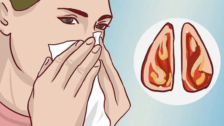 长期鼻炎的危害有哪些？