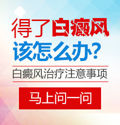 烟台白斑专科如何治疗白癜风会有好的