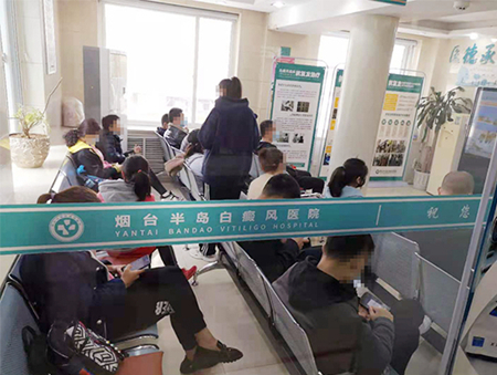 威海去哪里看烟台白癜风-威海白颠病烟台半岛真