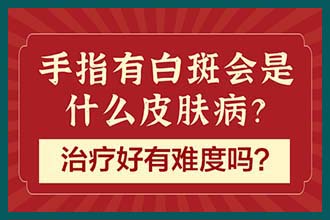 昆明有看白癜风的医院 对患者的心理有什么伤害