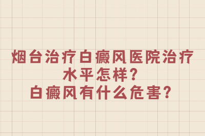 烟台治疗白癜风医院治疗水平怎样 白癜风会有哪些危害