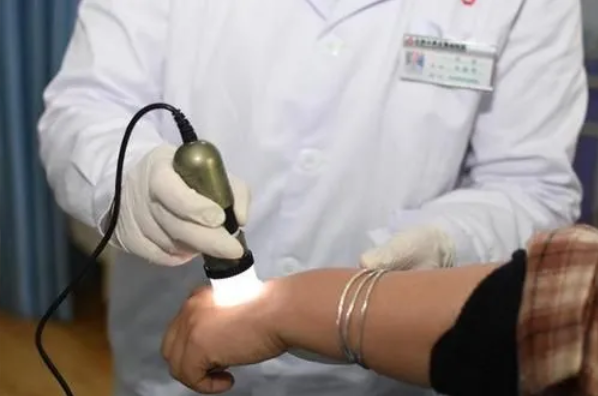 阜阳白癜风医院排名 白癜风的治疗方法有哪些