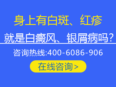 银屑病放血越来越严重-银屑病放血疗法贴吧