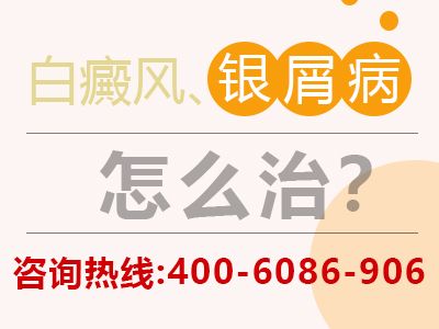 脸上长了一块白圈中间不是白癜风-为什么脸上会突然出现一块白圈