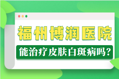 福建省福州白点癫风医院怎么治疗好-福州治疗白癜风去哪家