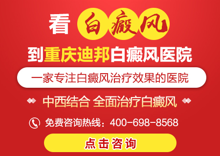 白癜风患者要避免哪些不良习惯