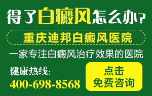 乐山白癜风医院哪好-白癜风扩散到了全身怎么办