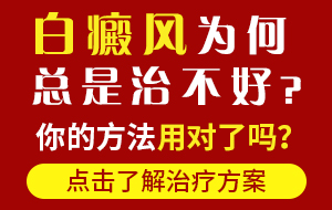 自贡哪里看白癜风好-白癜风不治疗会有哪些危害