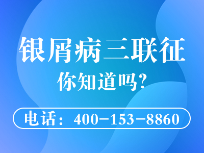 黑龙江治疗银屑病医院怎么走-黑龙江专科银屑病医院哪里好