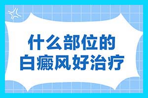 白点癫风不能吃的食物有哪些?