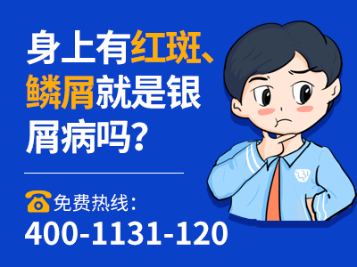 牛皮血癣晚期症状图片_身上的牛皮癣是什么原因造成的