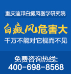 雅安哪里看白癜风效果好 白癜风患者怎么样治疗更好