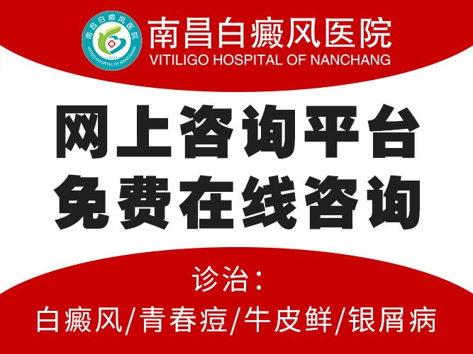 南昌治疗白癜风有哪些正规医院-白癜风不同类型的症状表现有哪些?