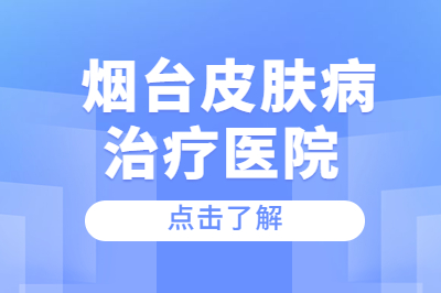 烟台皮肤病治疗医院如何治疗青少年银屑病