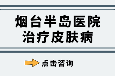 烟台半岛皮肤病治疗的医院好吗-怎么选择治银屑病的医院