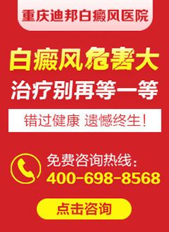重庆市白癜风治疗 恐惧不利于白癜风病情恢复。