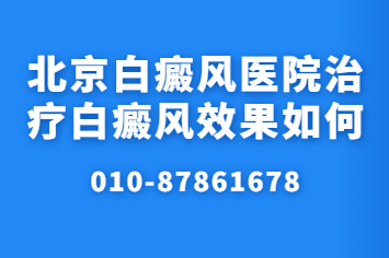 北京卫人医院治疗实力怎么样-北京本地患者觉得怎么样