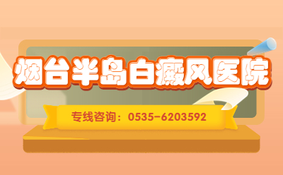 烟台治白癜风的医院有没有好的-儿童白斑怎么治疗好