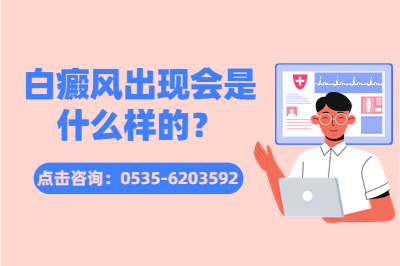 东营有什么专业的白癜风医院-白癜风是怎么形成的