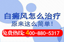 治疗白癜风医院排名前三公开 白癜风好好治疗的重要—怎样好好的治疗中老年白癜风