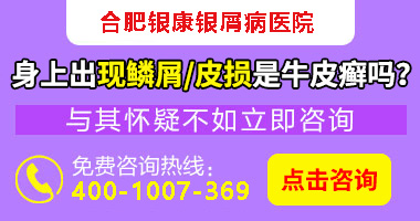 合肥银康医院治疗银屑病靠谱吗专业_合肥银康银屑病医院评价