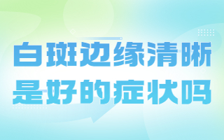 在烟台看白癜风哪里好-烟台白癜风有哪些治疗的方法 盲目中断治疗有哪些危害