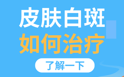 白癜风报道 白癜风郑州哪家医院能看好