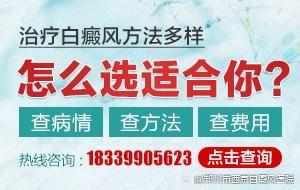 福建‘福州’白癜风医院哪家好‘今日推荐’福州治疗白癜风去哪个医院比较好