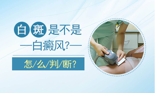 烟台半岛白癜风医院 烟台半岛医院收费多少