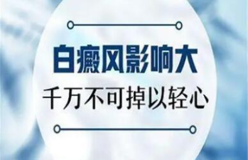 烟台治疗白斑哪里好 烟台白癜风治疗医院