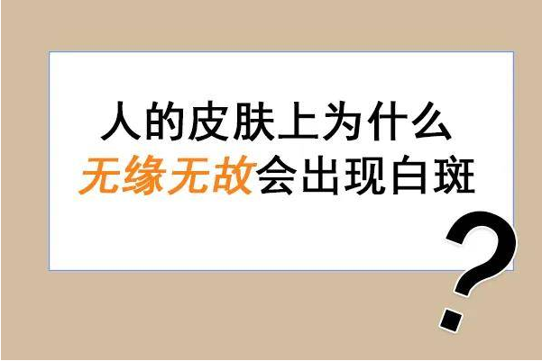 烟台正规白癜风医院 烟台治疗白癜风哪家好
