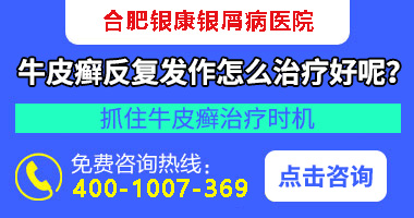 银屑病皮损挤出水_牛皮癣皮损挤出水