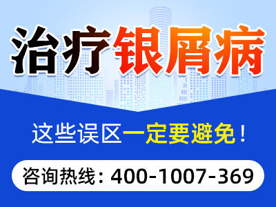 合肥银康银屑病医院坑人吗 _合肥银康银屑病医院治疗银屑病