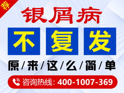 合肥银康银屑病医院治疗牛皮癣真的管用吗