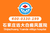 石家庄治疗白癜风去哪个医院-脚部白癜风的护理该怎么做