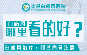 南昌市白癜风医院排名今日公开！为什么白癜风要马上治疗?