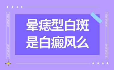烟台半岛医院-烟台哪家白癜风医院好