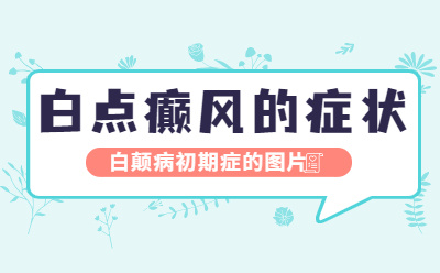 郑州西京治疗白癜风怎么样 白癜风初期会表现出什么样的症状