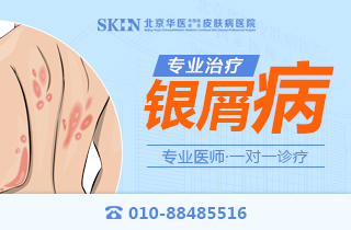 北京哪个医院银屑病排名好-湿疹和银屑病的区别在哪里呢